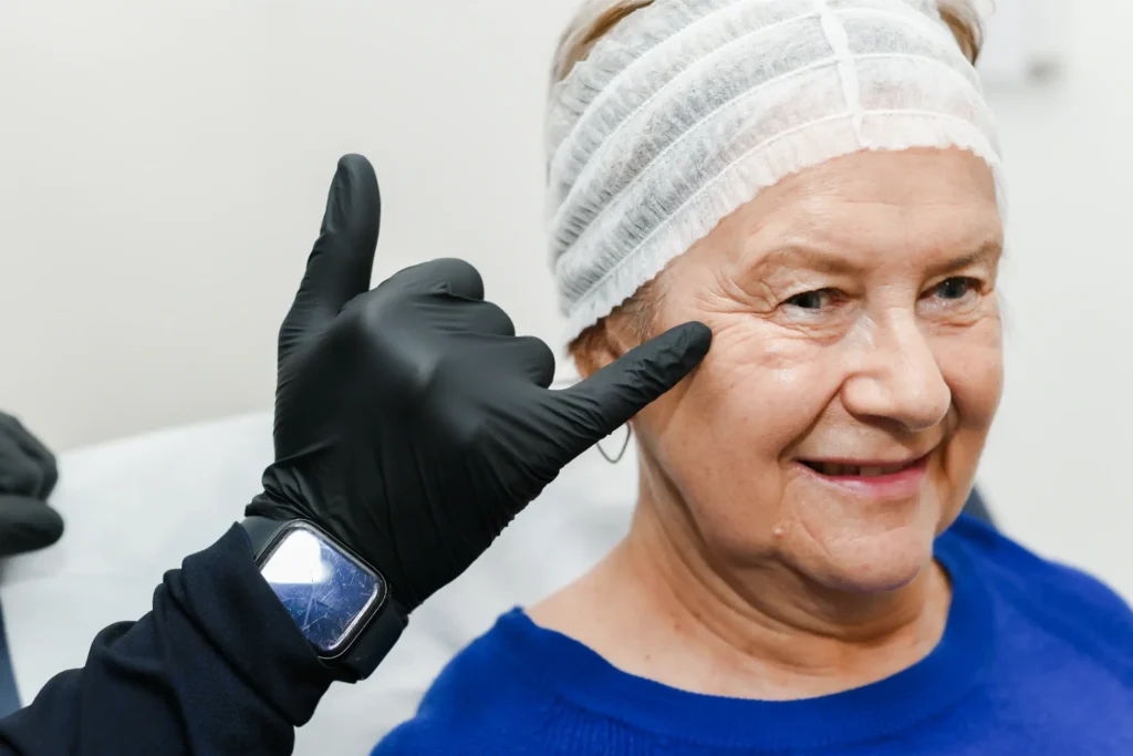 Assessing the wrinkles prior to treatment