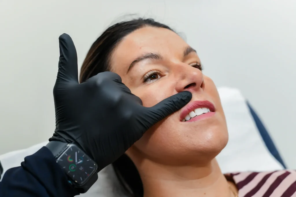 Analysing before a lip flip treatment
