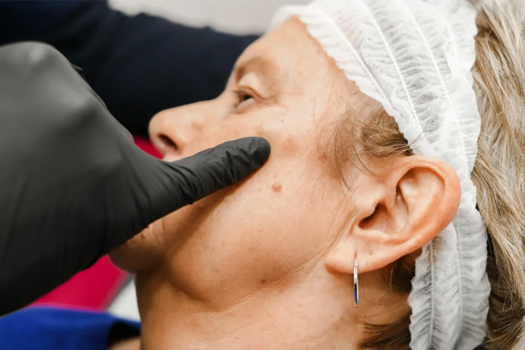 Analysing the pigmentation on a woman's face